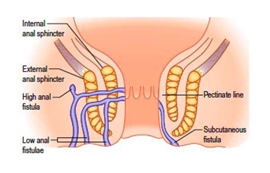 blog-image