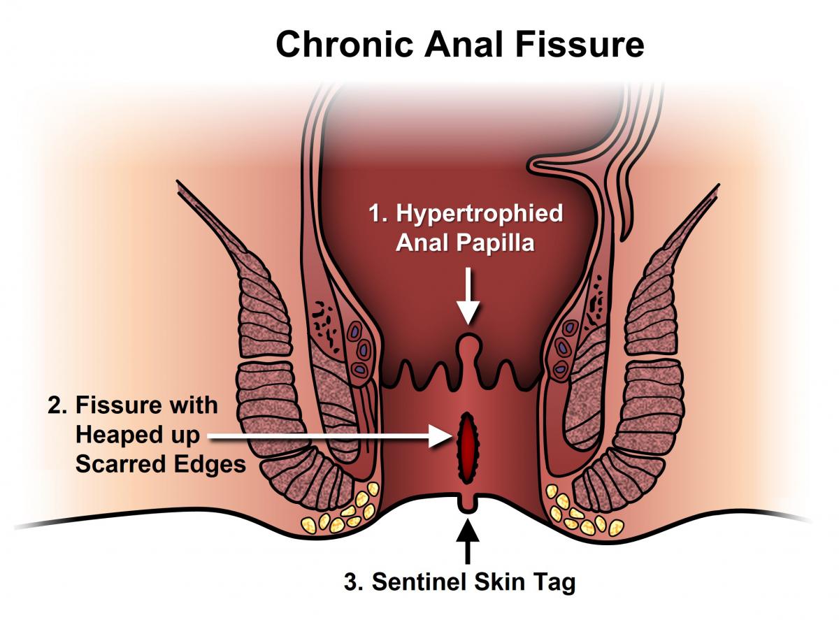 blog-image