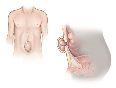 blog-image